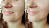 MASAJEADOR FACIAL MICROCORRIENTE - Efecto Lifting